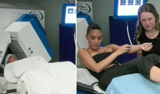 Kim Kardashian reveló que le han diagnosticado un aneurisma cerebral