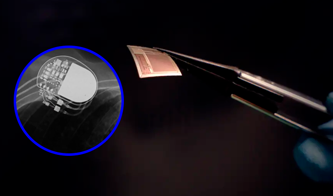 Científicos crean chip que conecta el cerebro con una computadora mediante el WiFi