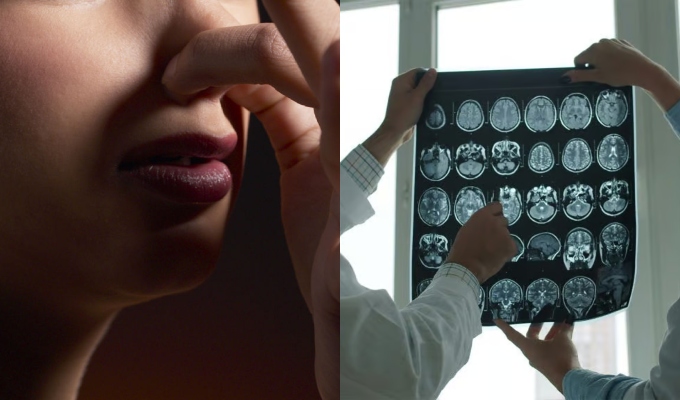 ¿Oler tus propias flatulencias podría tener beneficios para el cerebro? Esto dice un nuevo estudio