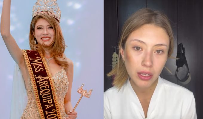Miss Arequipa 2025 denuncia agresión física por parte de su expareja: "Me repetía que me quitaría la vida"