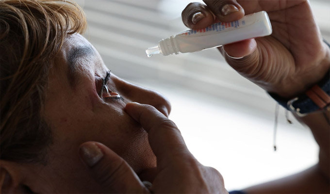 ¡Cuidado con la conjuntivitis! advierten alarmante aumento de infecciones oculares en verano