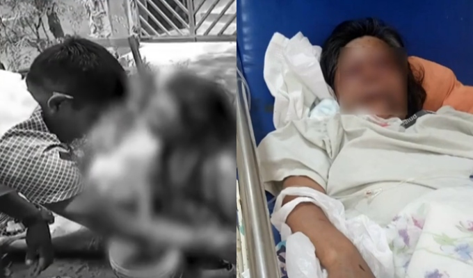 La masacró a puñetazos: hijo golpea brutalmente a su madre de 68 años