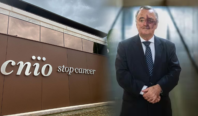 Científicos españoles logran eliminar el cáncer de páncreas más agresivo en ratones