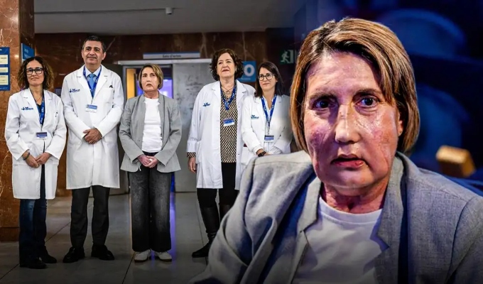 España: realizan el primer trasplante de cara del mundo con donante que accedió a eutanasia