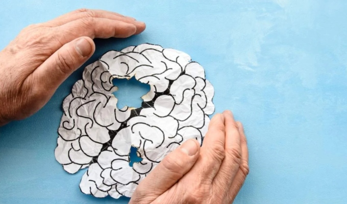 ¿La demencia no empieza en el cerebro? Investigación revela vínculo con 16 enfermedades comunes