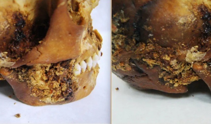 Hallan cráneo con cirugía maxilofacial de hace 2 500 años