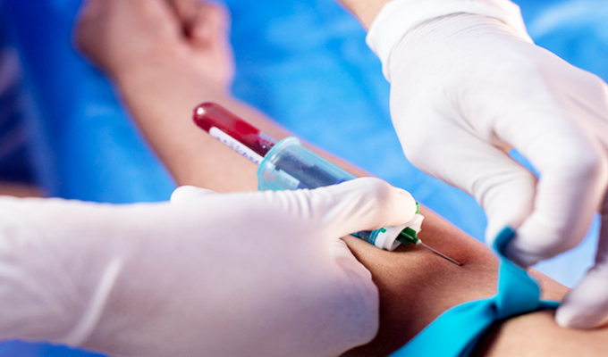 Especialista de la Salud alertan que la prediabetes afecta silenciosamente a uno de cada cinco peruanos