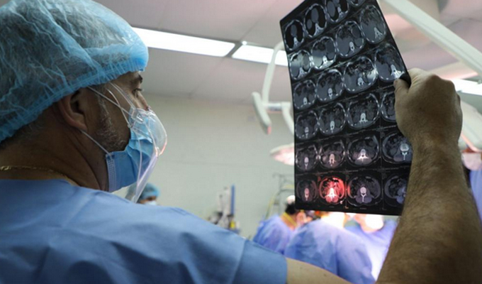 Pérdida de peso, falta de apetito y dolor abdominal pueden ser signos de cáncer de páncreas