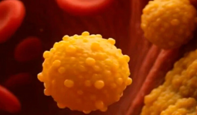 Científicos revelan cómo la grasa corporal impulsa el crecimiento del cáncer