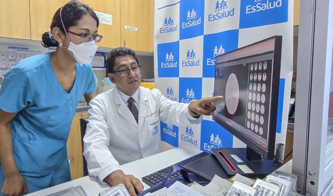 EsSalud logra salvar a paciente con infarto cerebral y evita secuelas tras atención oportuna