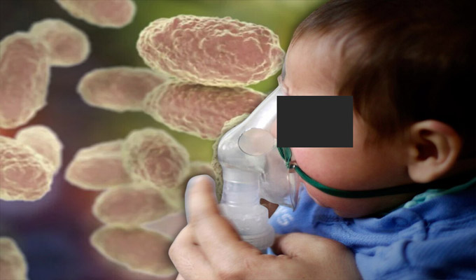 Declaran en emergencia sanitaria Loreto por casos de tos ferina: medida regirá por 90 días