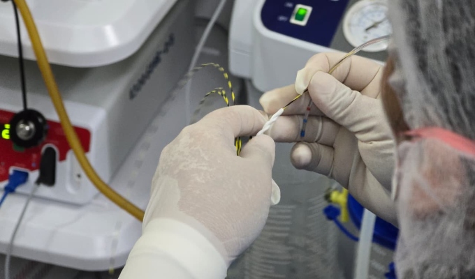 EsSalud libera de tres años de dolor recurrente a paciente con obstrucción biliar tras colocarle prótesis biodegradable