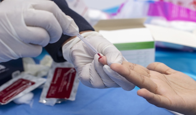 Hospital Santa Rosa realizará jornada gratuita de despistaje de VIH este miércoles