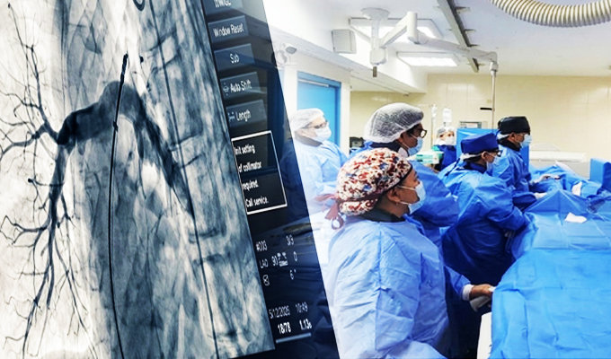 Especialistas de EsSalud corrigen cardiopatías congénitas de 10 pacientes en menos de 48 horas