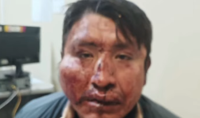 De víctima a agredido: ciudadano denuncia tortura policial en Puno