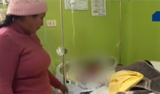 Niña de 8 años sufre graves quemaduras y pierde varios dedos tras manipular pirotécnico