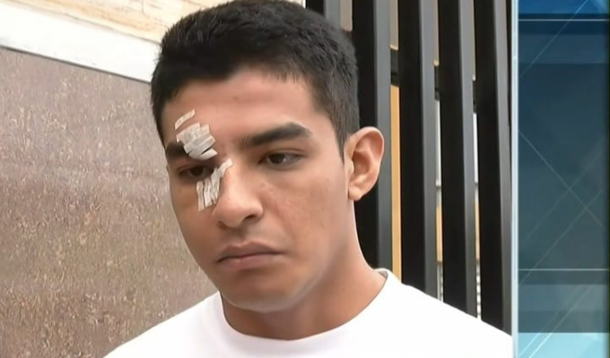 Estudiante denuncia brutal agresión de su compañero dentro de universidad