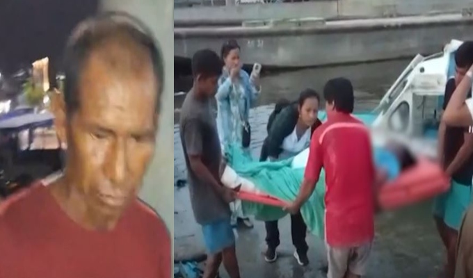 Iquitos: mujer termina con el 30 % de su cuerpo quemado tras un presunto ataque de su pareja