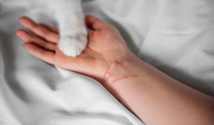 Arañazos de gato: INS advierte sobre una posible infección