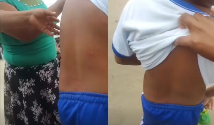 Sullana: escolares terminan con picaduras de pulgas y padres exigen fumigación en colegio