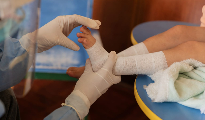 Aniquem lanza campaña para rehabilitación de niños sobrevivientes de quemaduras