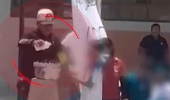 Piura: niño termina con graves quemaduras en el rostro tras imprudencia de profesor