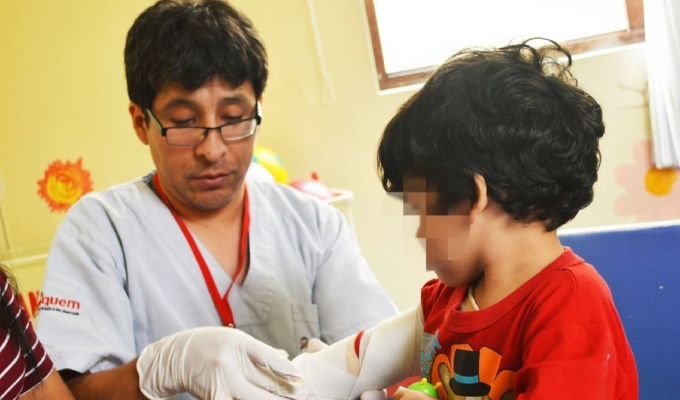 Aniquem realizará campaña gratuita quirúrgica a sobrevivientes de quemaduras en Lambayeque