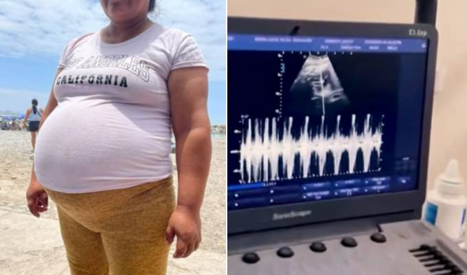 Callao: trasladan a madre de gemelas al Centro Emergencia Mujer