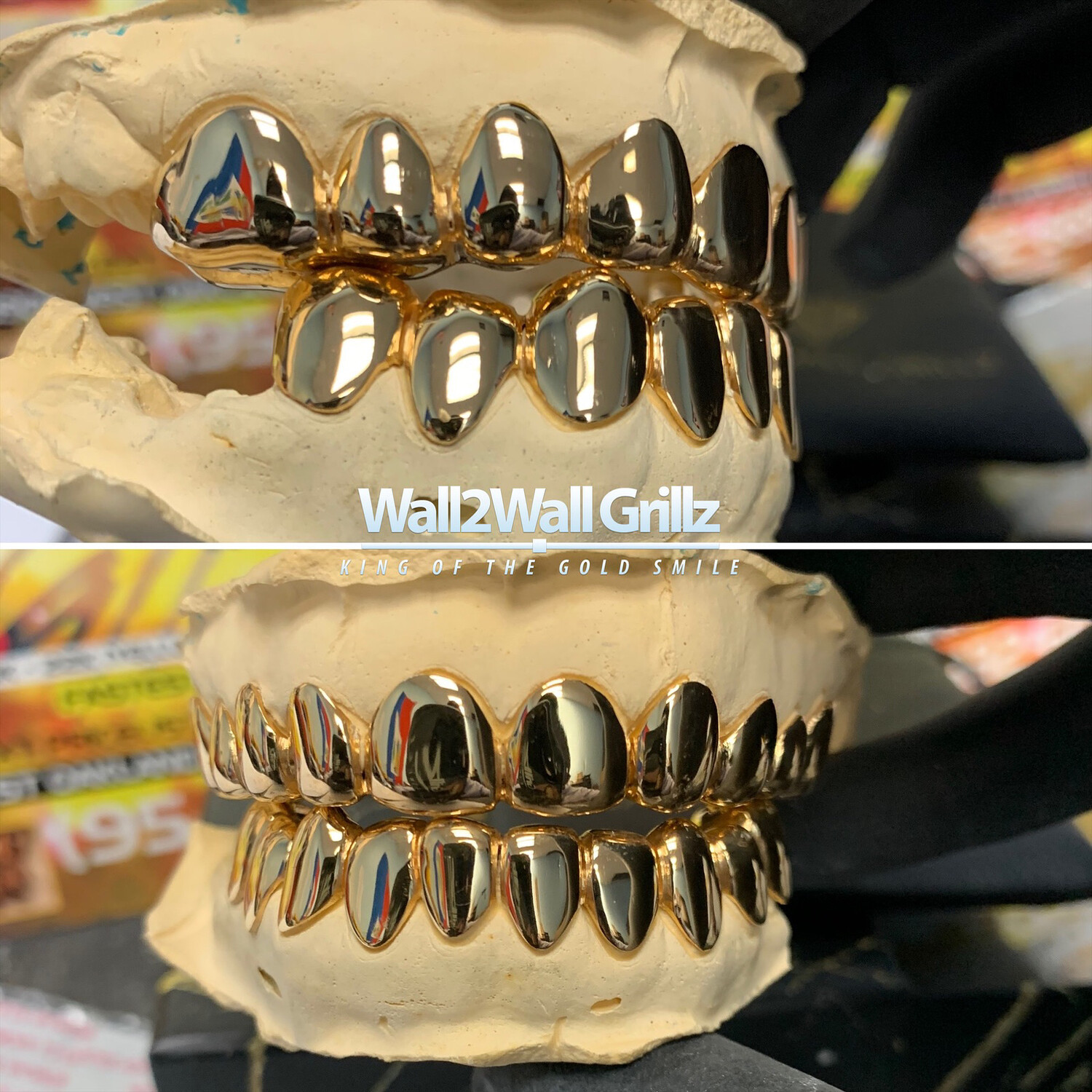NonPrecious Gold Alloy (NPG) (30 Per Tooth)