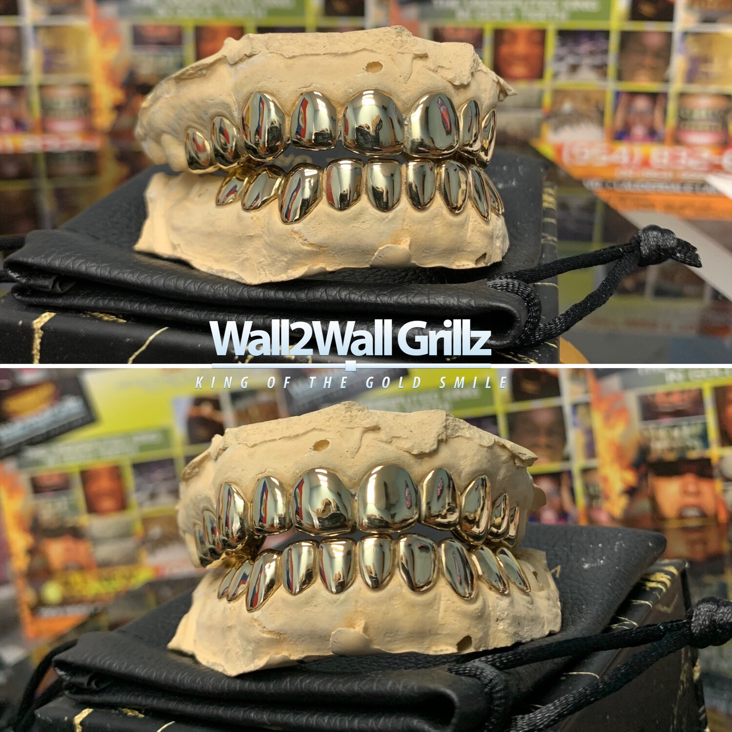 14 Karat Gold Grillz (100 Per Tooth)