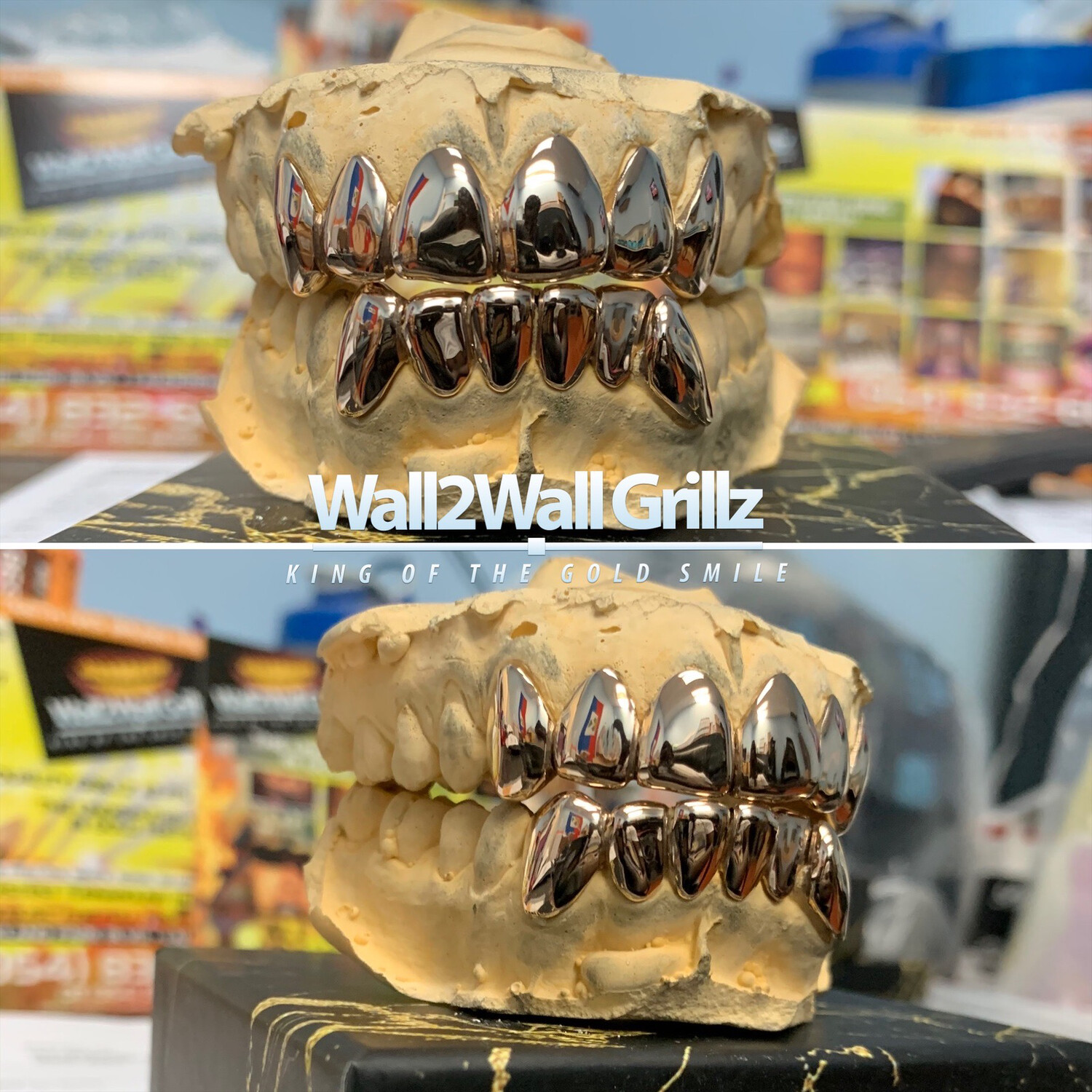 10 Karat Gold Grillz (105 Per Tooth)