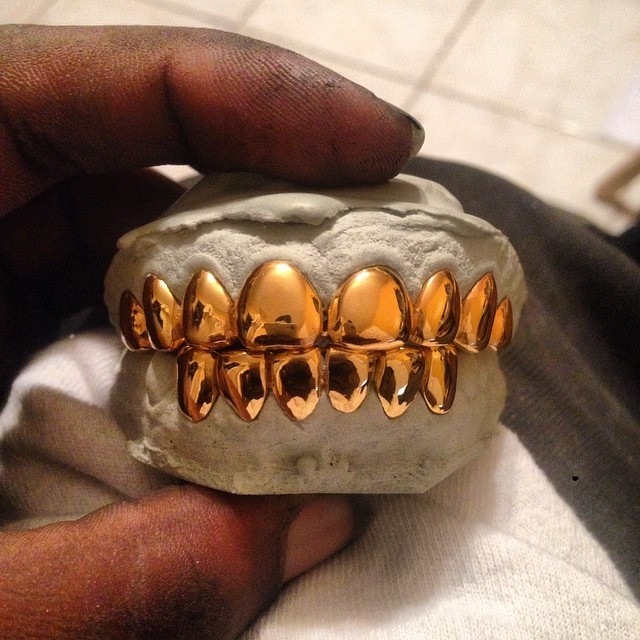 NonPrecious Gold Alloy (40 Per Tooth)