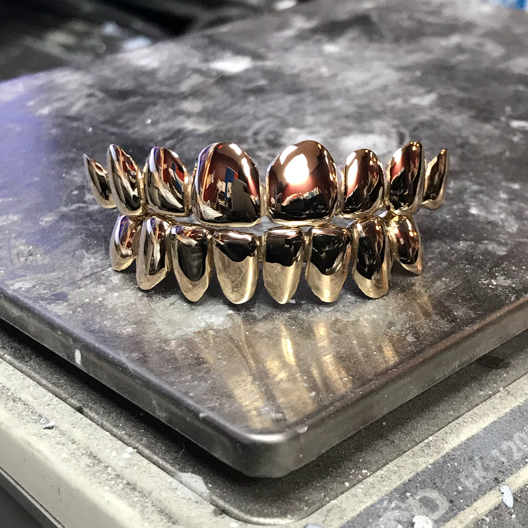 18 Karat Gold Grillz (150 per tooth)