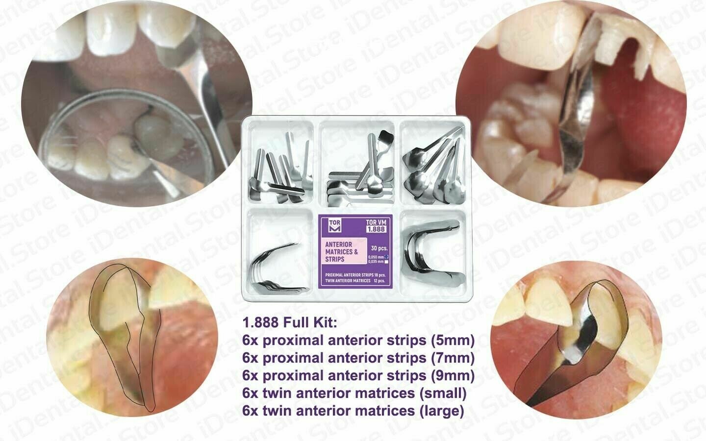 DENTAL ANTERIOR TWIN MATRICES & STRIPS restoration PROXIMAL CERVICAL