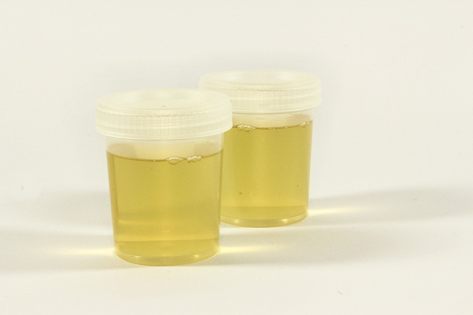 Non Regulated Lab Based Urine Collection UNOBSERVED