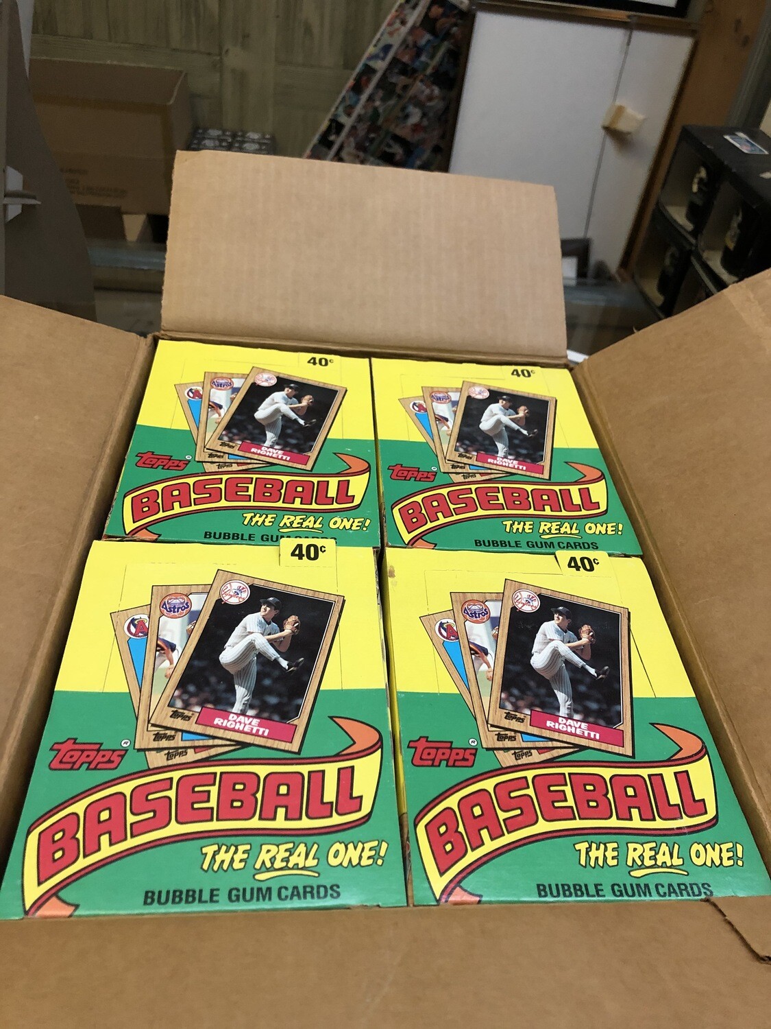 1987 Topps Baseball 20 box Case