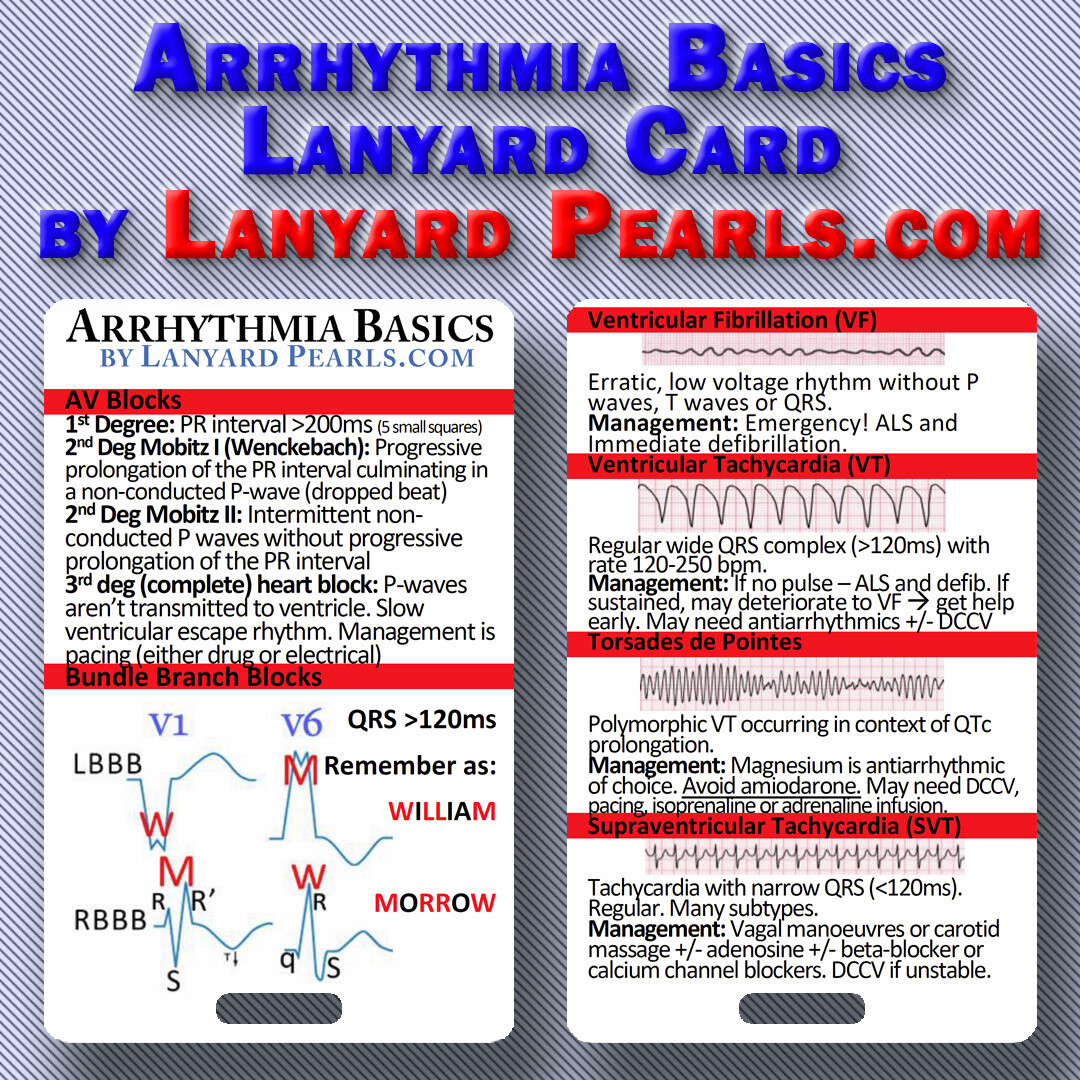 Cardiac Arrhythmia Basics Medical Lanyard Card