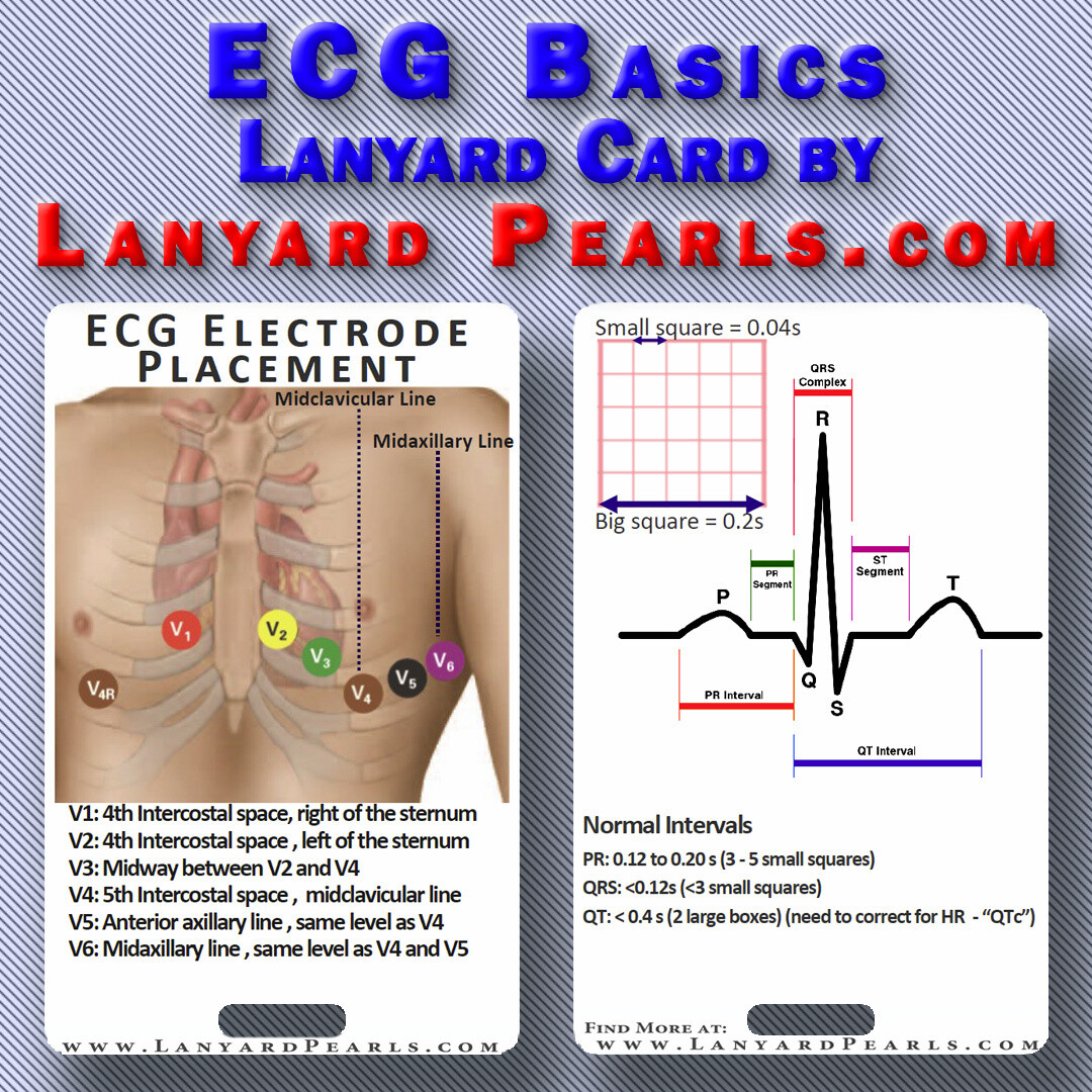 ECG Basics || Lanyard Medical Reference Card