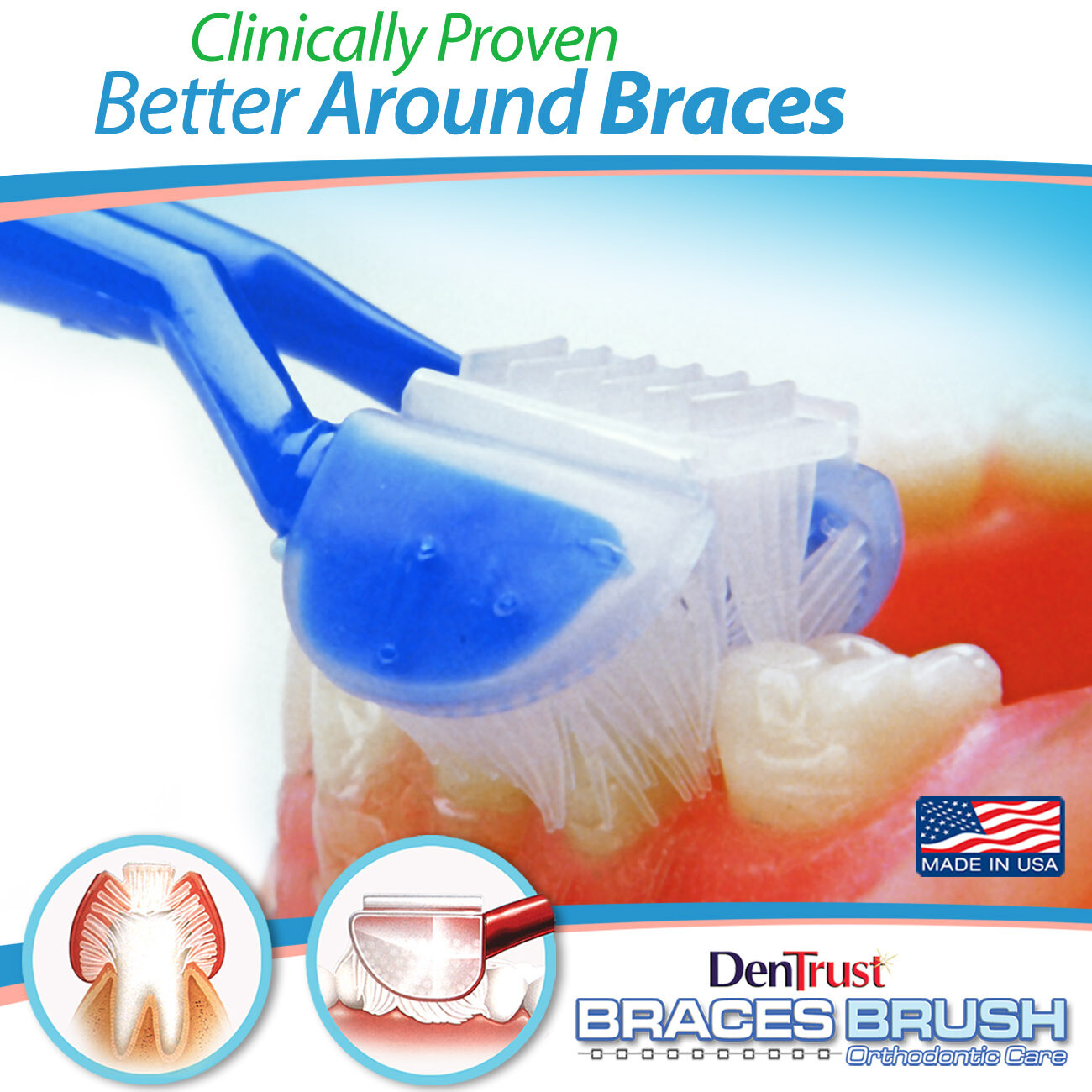 DenTrust BRACES BRUSH Clinically Proven Orthodontic’s Store