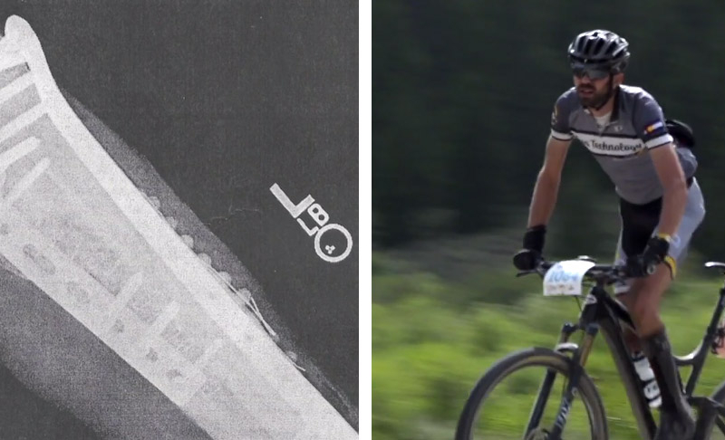 The Ride From Injury That ‘Changed It All’