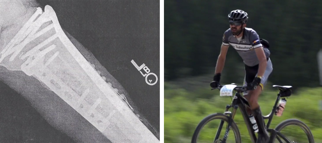 The Ride From Injury That ‘Changed It All’