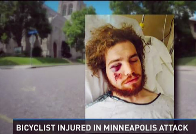 biker-attacked