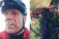 The Scary Trend of Booby-Trapped Bike Trails