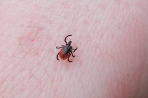 $8 Million Tick Study Aims To Curb Lyme Disease
