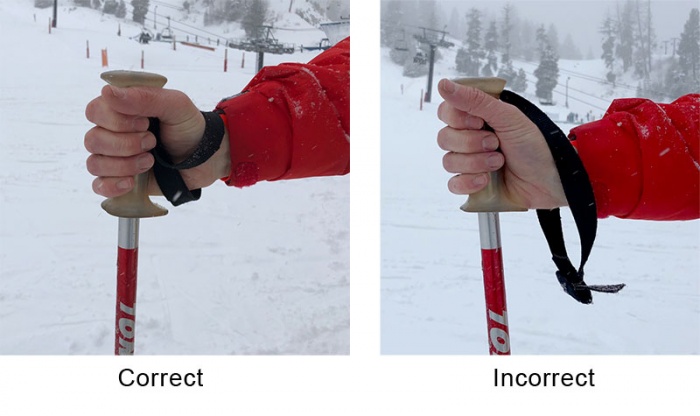 skiers thumb