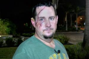 Apparently You Can Get Mauled By a Bear in Florida