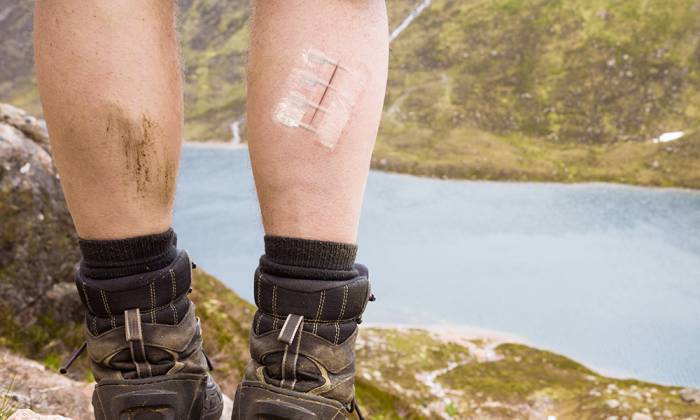 Free Gear Fridays: ZipStitch Laceration Kit Giveaway