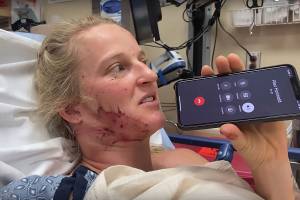 ‘The Accident’: Emily Harrington, Adrian Ballinger Recount Near-Fatal Fall