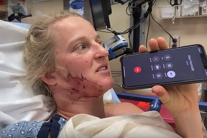 Emily Harrington calls Alex Honnold from hospital
