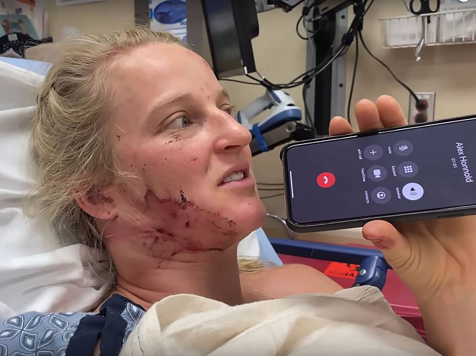 'The Accident': Emily Harrington, Adrian Ballinger Recount Near-Fatal Fall Emily Harrington calls Alex Honnold from hospital